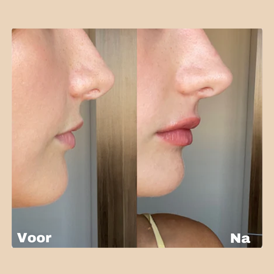 Zulla™ LipSerum+ UITVERKOCHT!