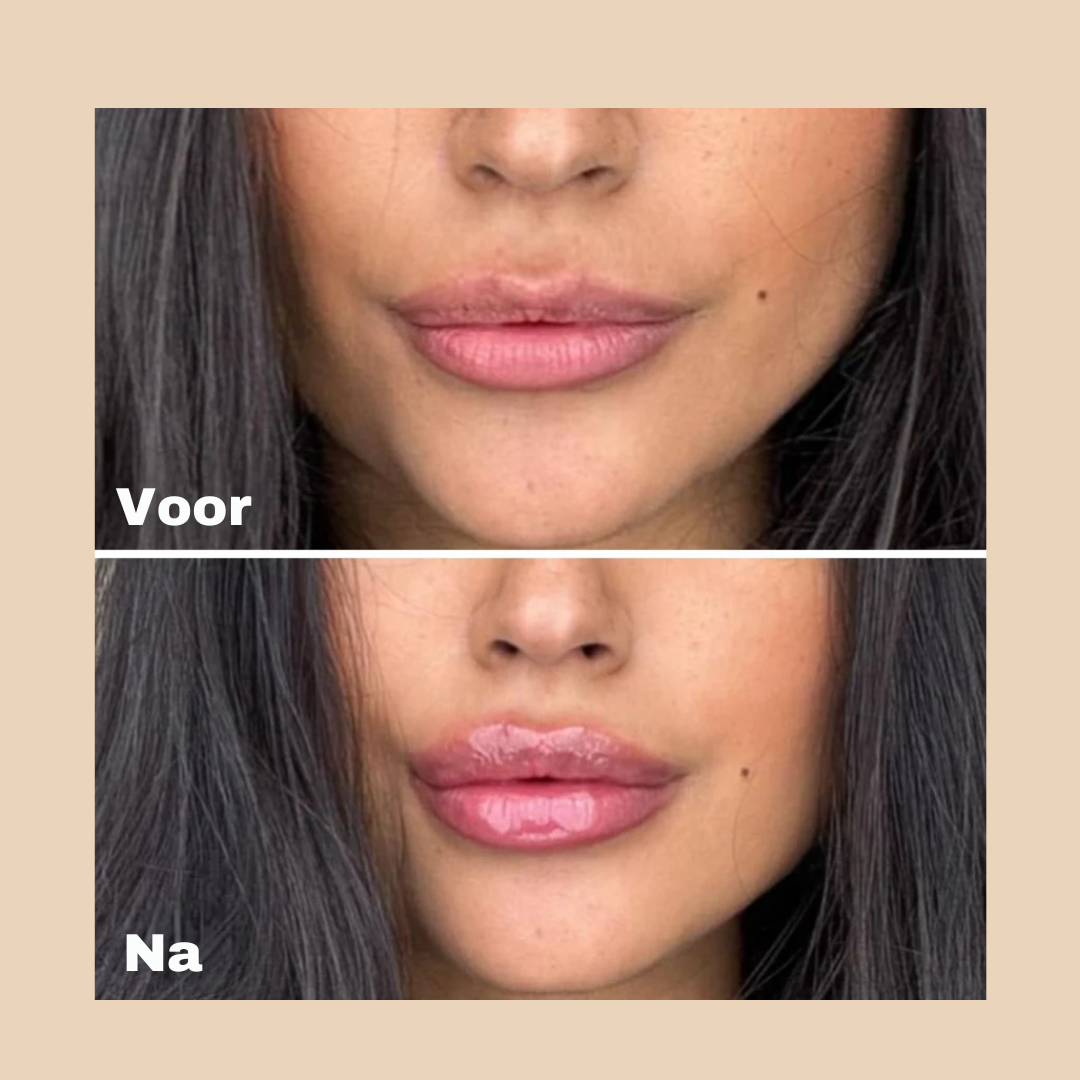 Zulla™ LipSerum+ UITVERKOCHT!